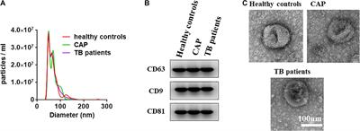 Two Small Extracellular Vesicle sRNAs Derived From Mycobacterium tuberculosis Serve as Diagnostic Biomarkers for Active Pulmonary Tuberculosis